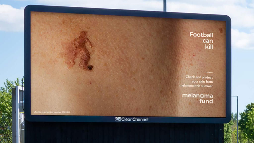 melanoma-fund-grains-de-beaute-sport-3.jpeg
