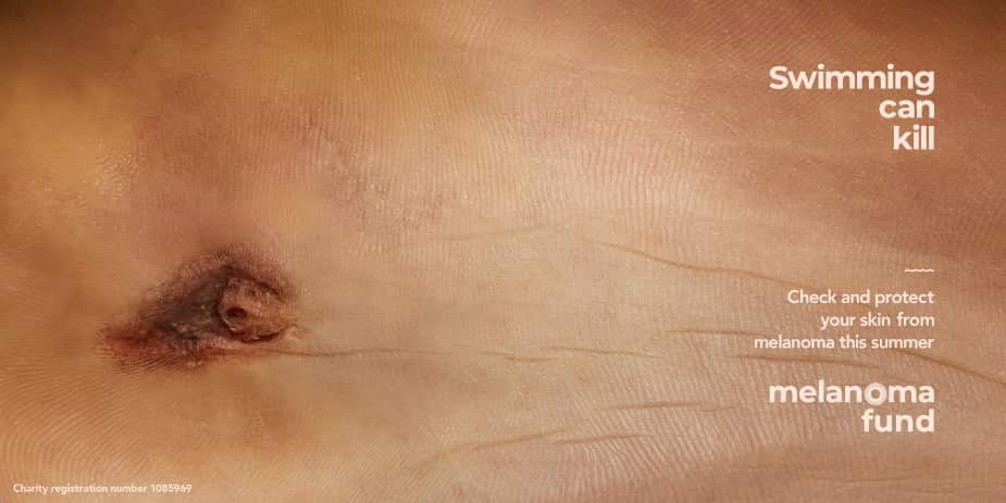 melanoma-fund-grains-de-beaute-sport-2.jpeg