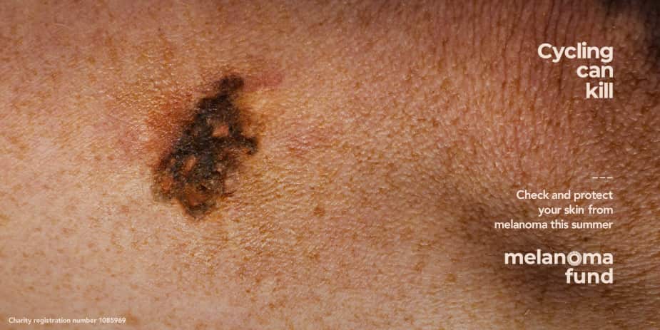 melanoma-fund-grains-de-beaute-sport-1.jpeg